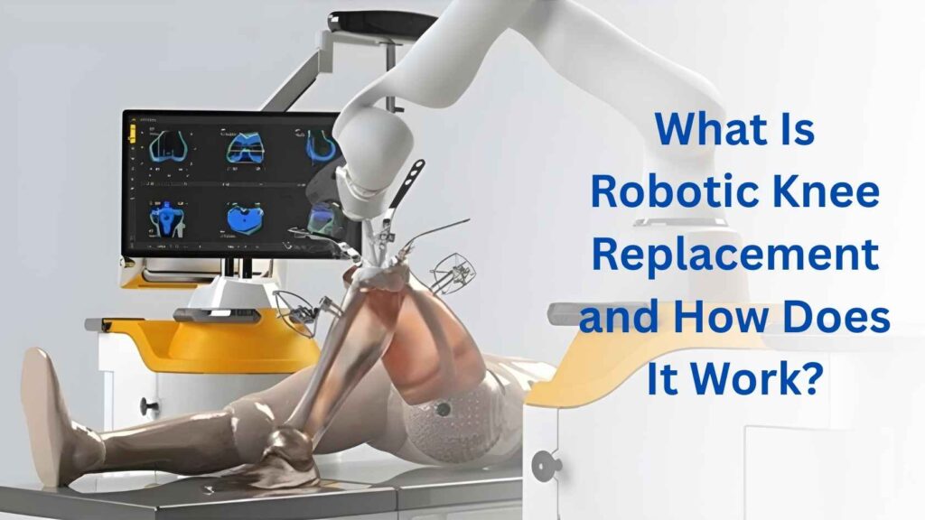 Robotic system assisting in knee replacement surgery with a robotic arm and digital planning interface.