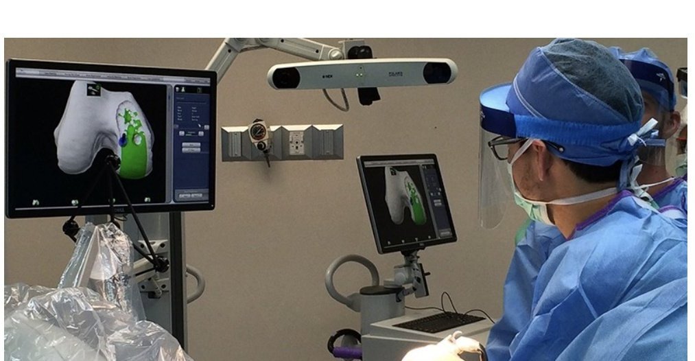 Step-by-step robotic knee replacement procedure using computer-assisted technology